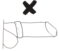 Incorrect Comfortring placement